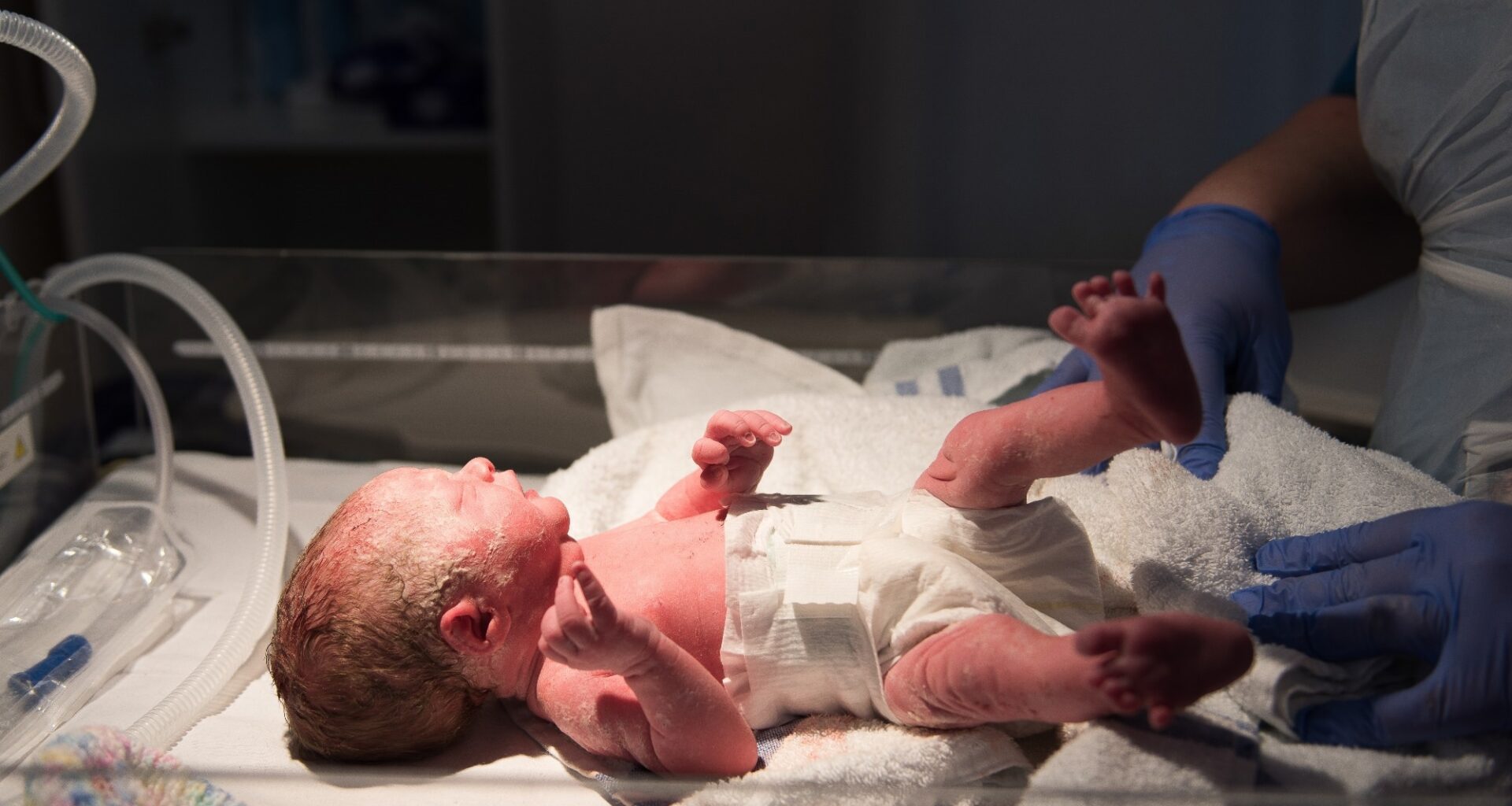 A young baby girl is born premature weighing just 4lbs, pictured here less than 5 minutes old