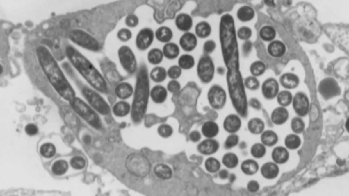 Legionnaires’ disease reported in Bronx after Harlem outbreak – NBC New York