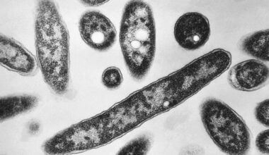 This 1978 electron microscope image made available by the Centers for Disease Control and Prevention shows Legionella pneumophila bacteria which are responsible for causing the pneumonic disease Legionnaires' disease. (Francis Chandler/CDC via AP, File)