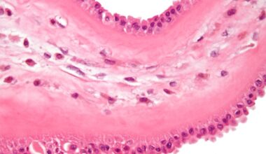 Decoding macrophage immune responses with gene editing and machine learning