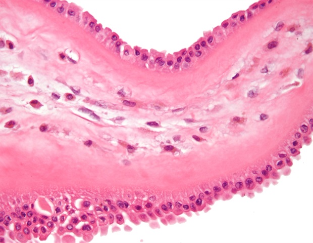 Decoding macrophage immune responses with gene editing and machine learning