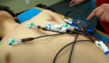Where to find free or low-cost heart screening testing for teens, young adults in the Houston area