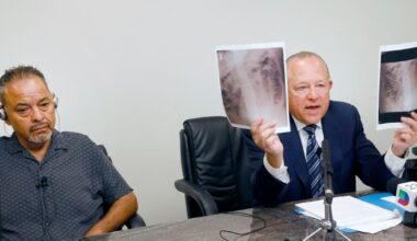 Dallas doctors left surgical tool inside patient’s body, lawsuit alleges