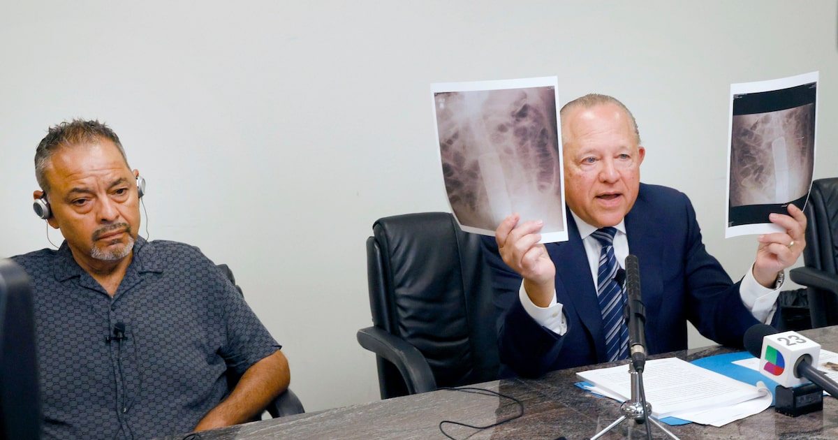 Dallas doctors left surgical tool inside patient’s body, lawsuit alleges