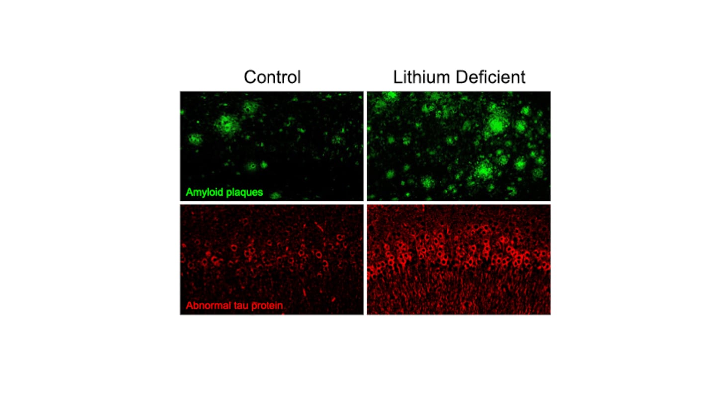 These images show what happens to the brains of Alzheimer's mice when they are placed on a lithium deficient diet.  It shows that lithium deficiency markedly increases the number of amyloid plaques and the number of tangle-like structures in the brain, resembling advanced Alzheimer's disease in humans.
