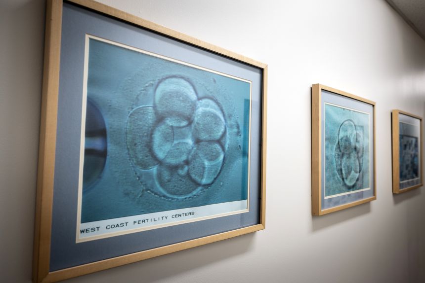 Images of cells dividing are seen at West Coast Fertility Centers in February 2024 in Fountain Valley, California.