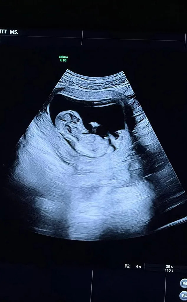 <p>Live From New York, It&rsquo;s a Baby!</p>