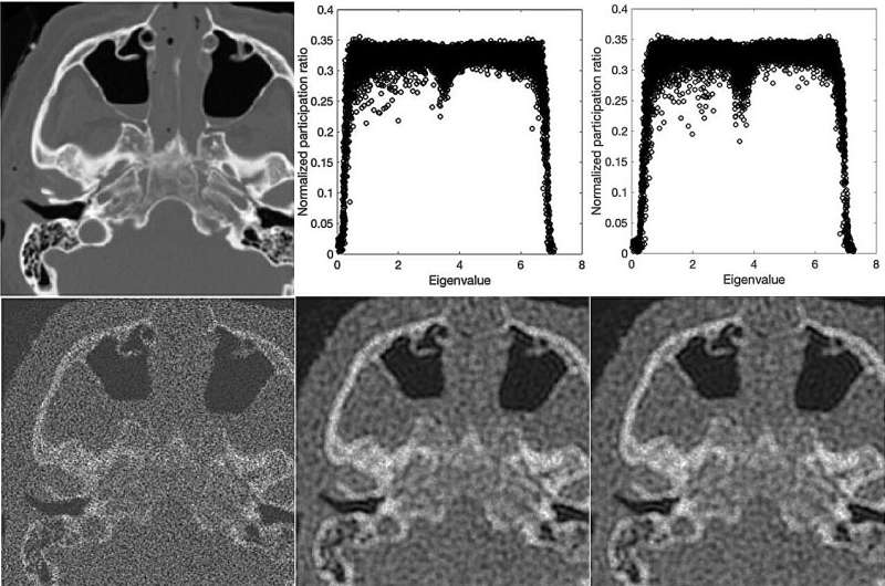 Clarifying medical images using next-level pixel-particle analogy
