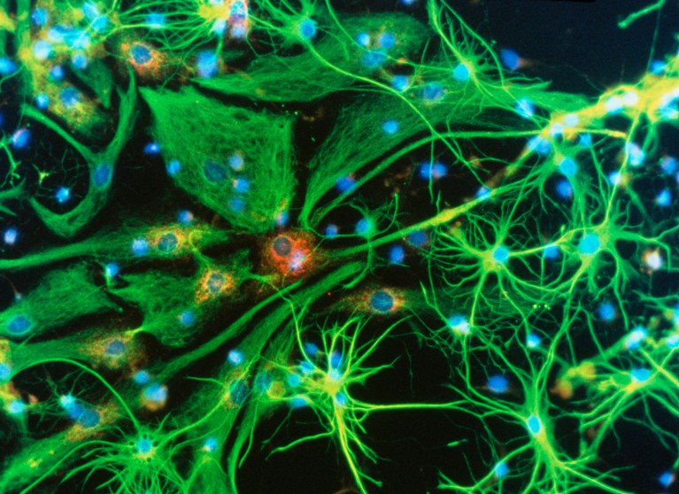 Immunofluorescent light micrograph of stringy-looking green brain cells, containing blue and red dots on a black background