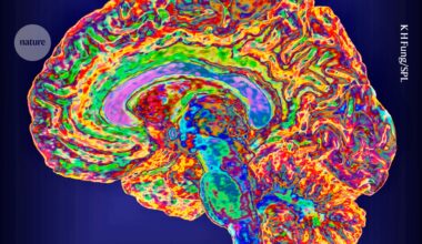 A mind–reading brain implant that comes with password protection