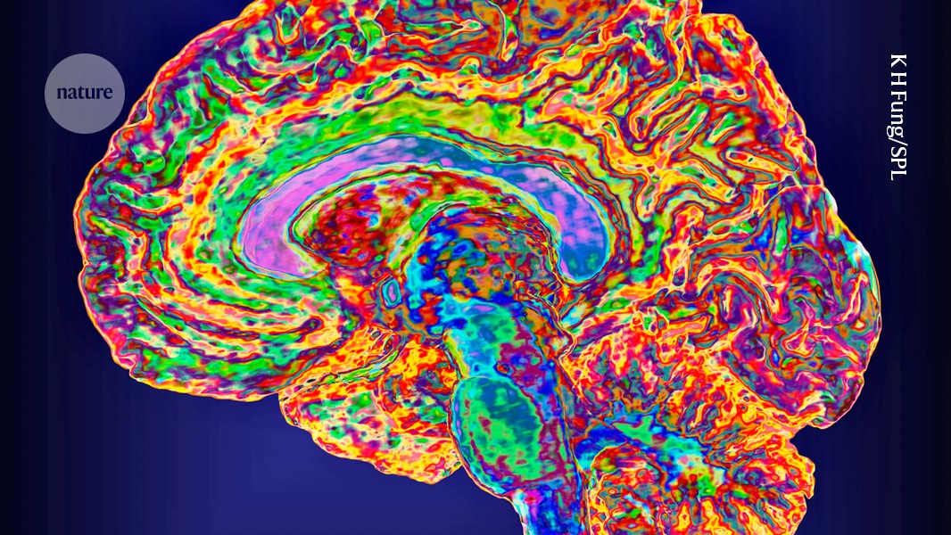 A mind–reading brain implant that comes with password protection