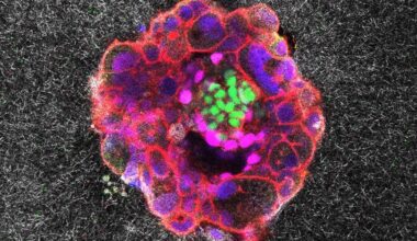 Watch a human embryo implant itself — with brute force