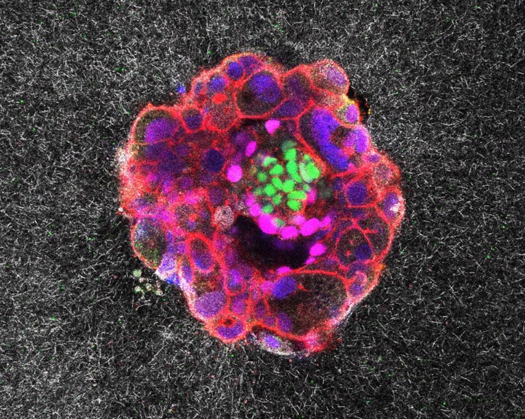 A confocal microscopy image of a nine-day-old human embryo shown in pink, red, green and blue colours on a grainy black background