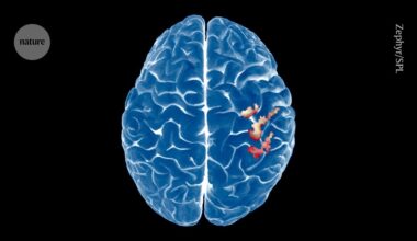 The brain’s map of the body is surprisingly stable — even after a limb is lost