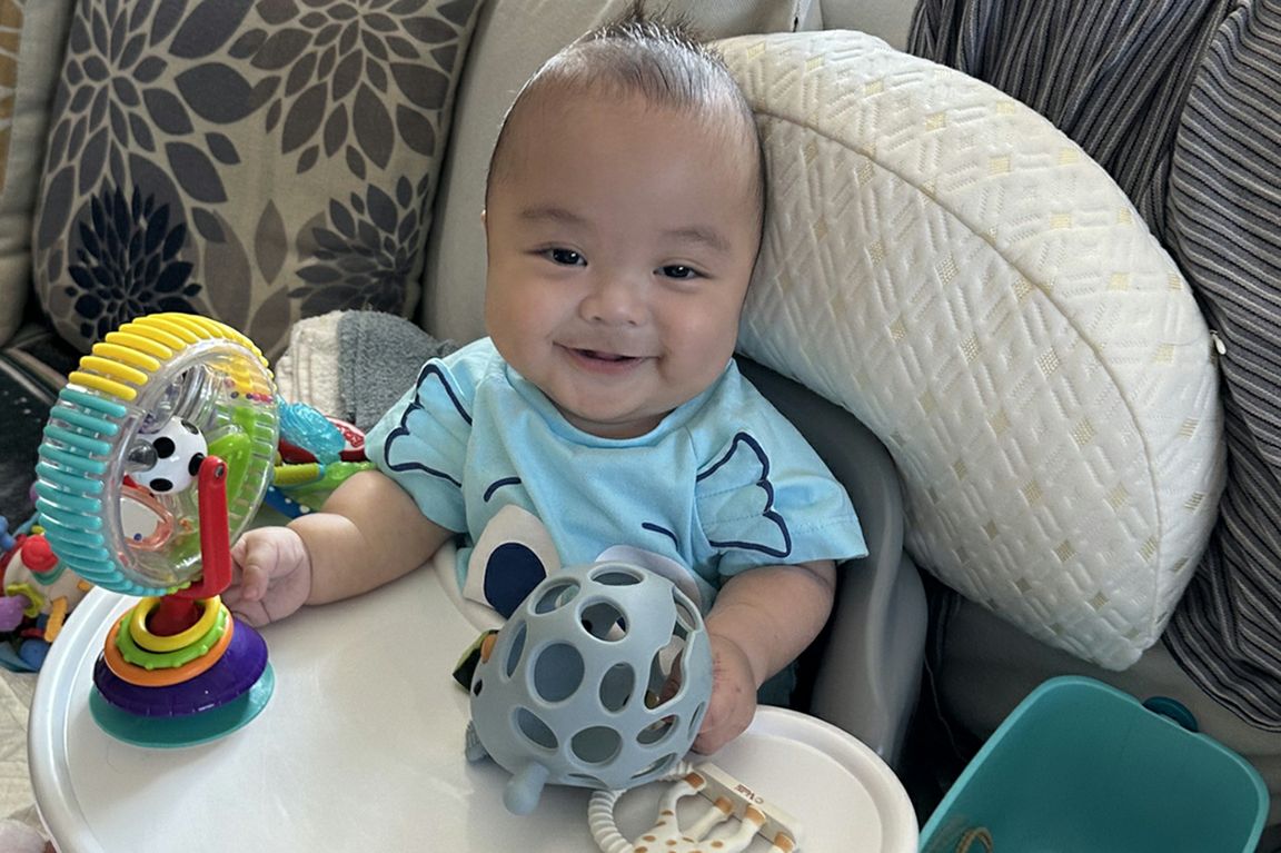 Baby diagnosed prenatally with hypophosphatasia thriving after immediate therapy at birth
