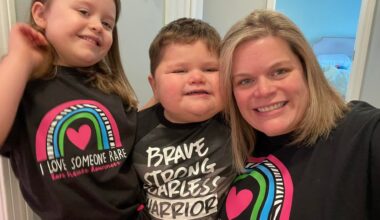 100-Pound 3-Year-Old Diagnosed With Rare Genetic Disorder