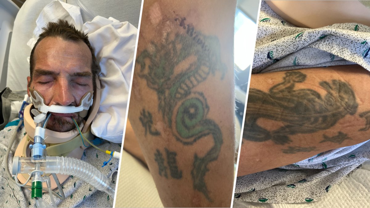 Temple Hospital asking for public’s help to identify patient – NBC10 Philadelphia