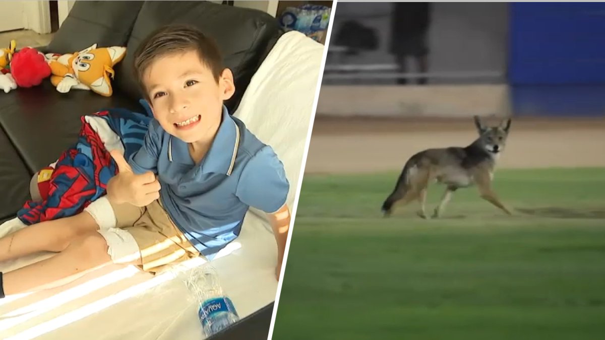 6-year-old boy attacked by coyote in Carson – NBC Los Angeles