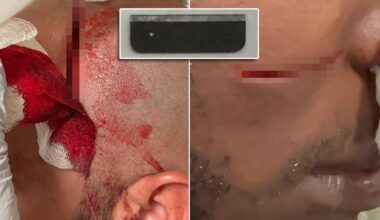 Two NYC Correction officers badly slashed by detainee on Rikers Island
