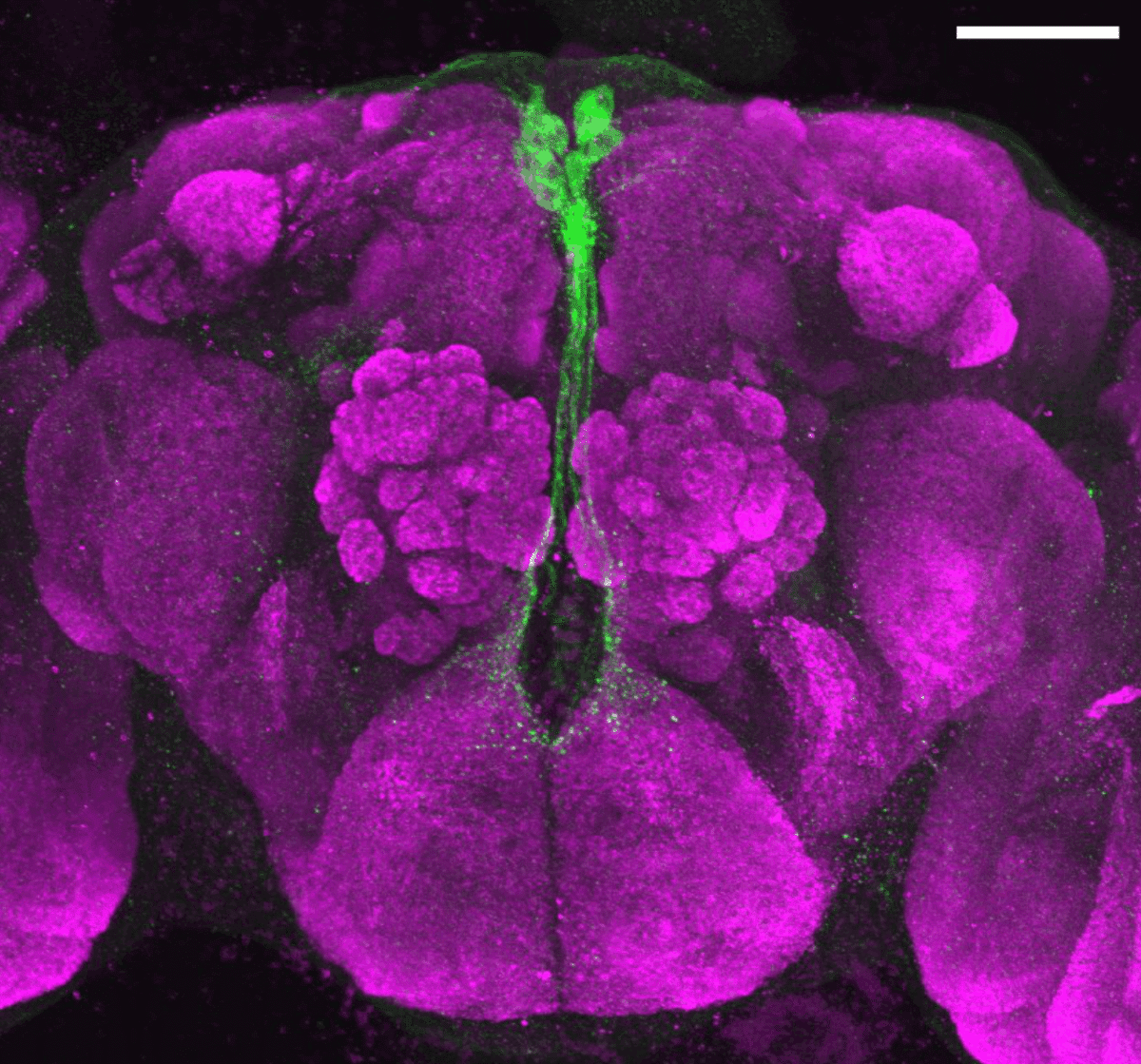 Insulin-producing neurons in Drosophila subobscura