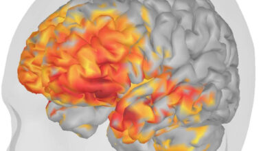 A MEG powerhouse: How UTSW is pushing the limits of brain research, care: Newsroom