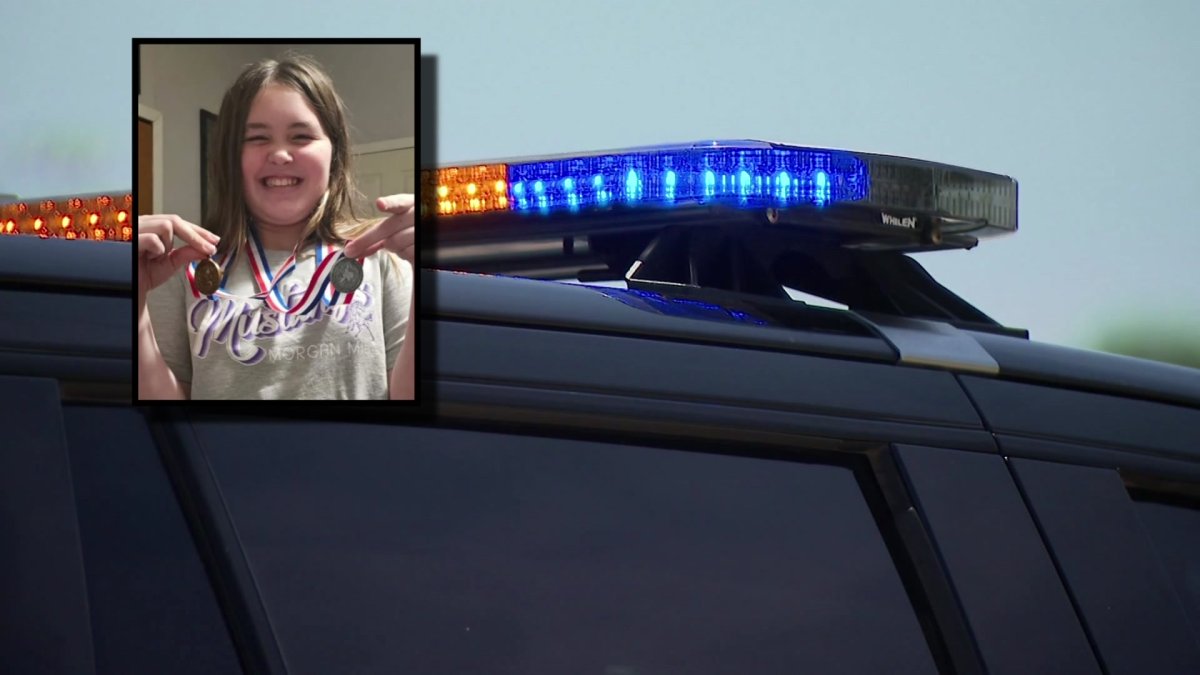 North Texas girl recovering after hog attack – NBC 5 Dallas-Fort Worth