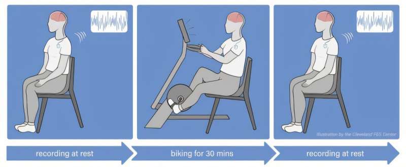 Researchers at university hospitals and the Cleveland VA say long-term exercise programs may restore neural connections in Parkinson's patients