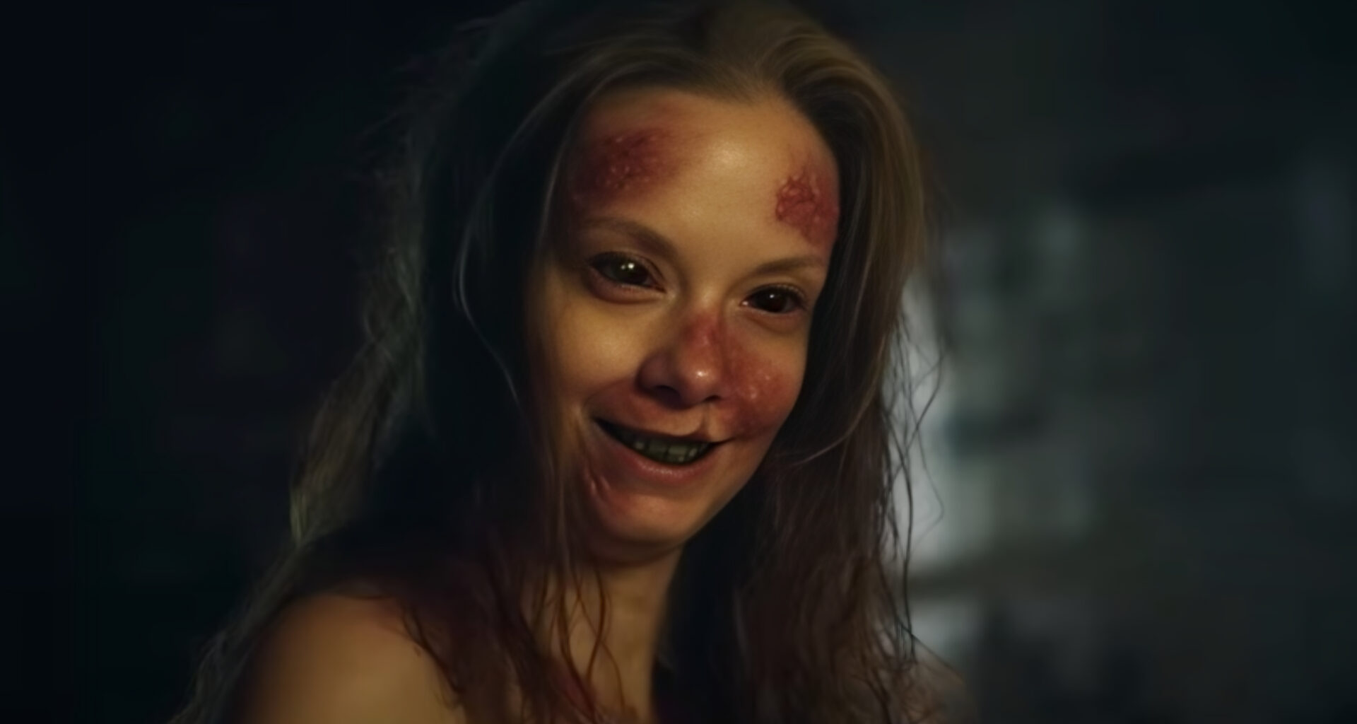 Traumatika