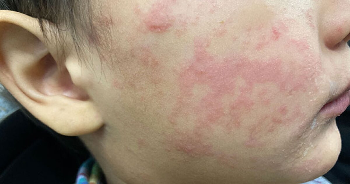 After a lifetime developing vaccines, this ASU researcher's new challenge is disinformation