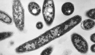 Legionnaires’ disease in New York City: 4th person dies after dozens sickened in Harlem