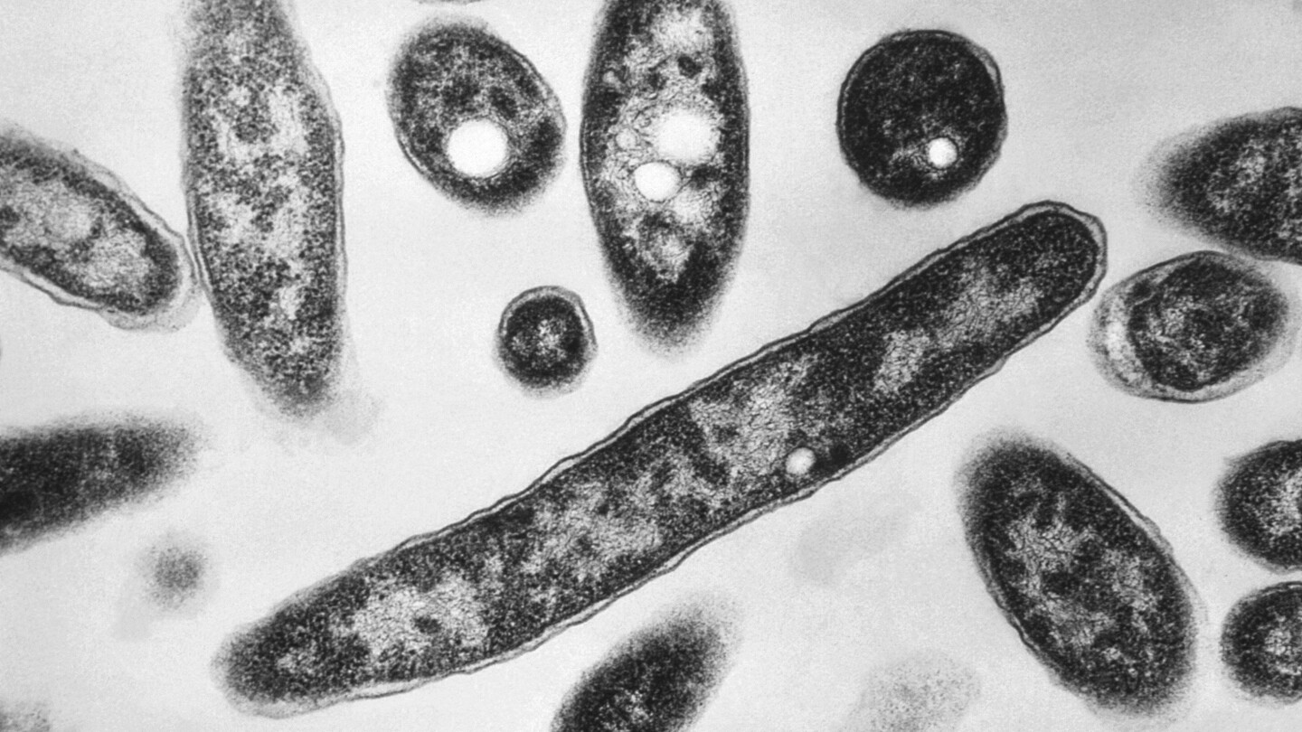 Legionnaires’ disease in New York City: 4th person dies after dozens sickened in Harlem
