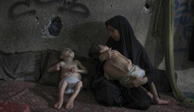 PHOTO ESSAY: Starvation attacks the bodies of these children in Gaza
