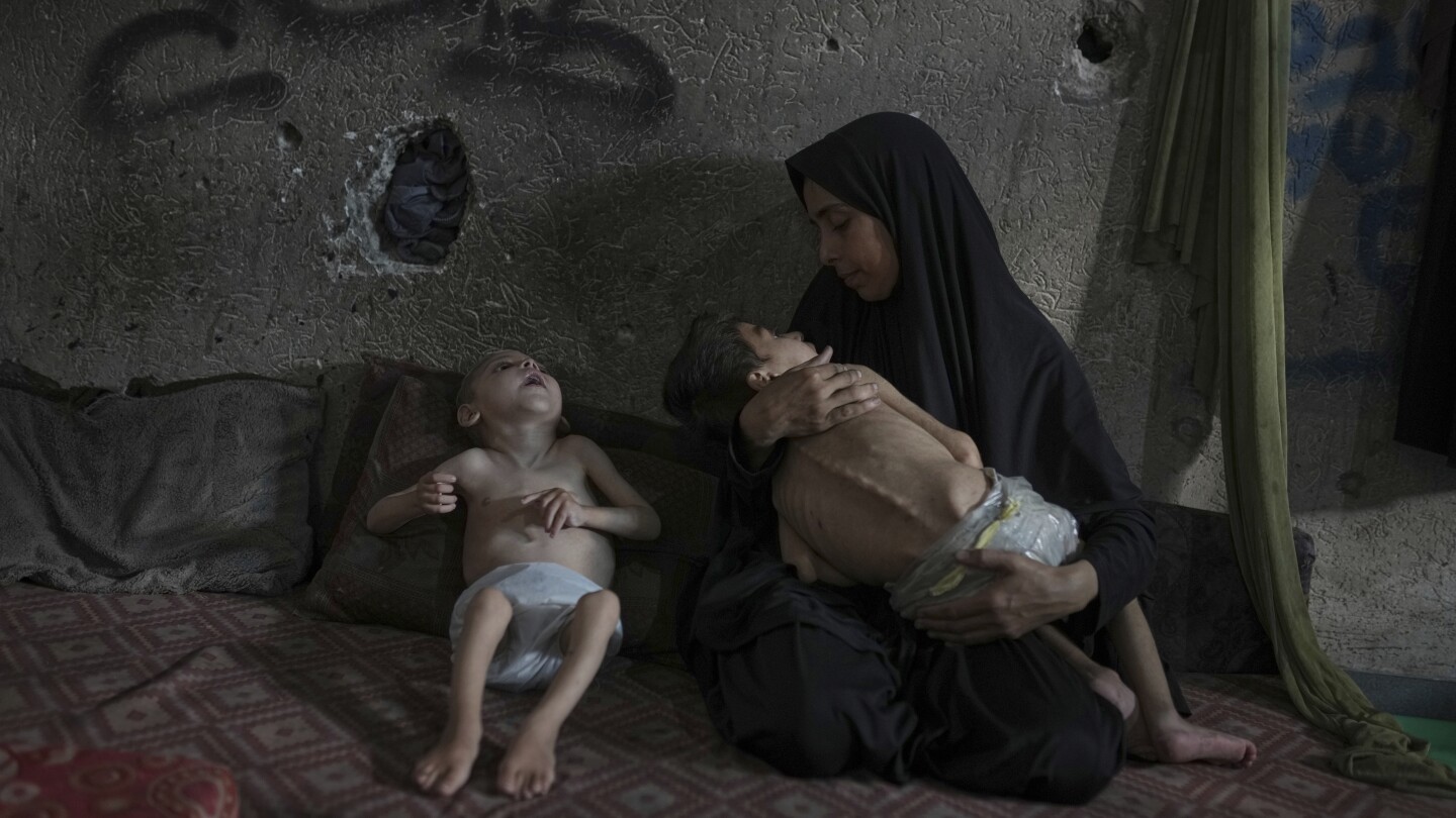 PHOTO ESSAY: Starvation attacks the bodies of these children in Gaza