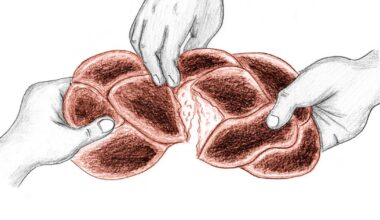 Contributor: Food for all over security for some