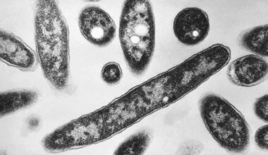 4th person dies after a Legionnaires’ disease outbreak sickens dozens in New York