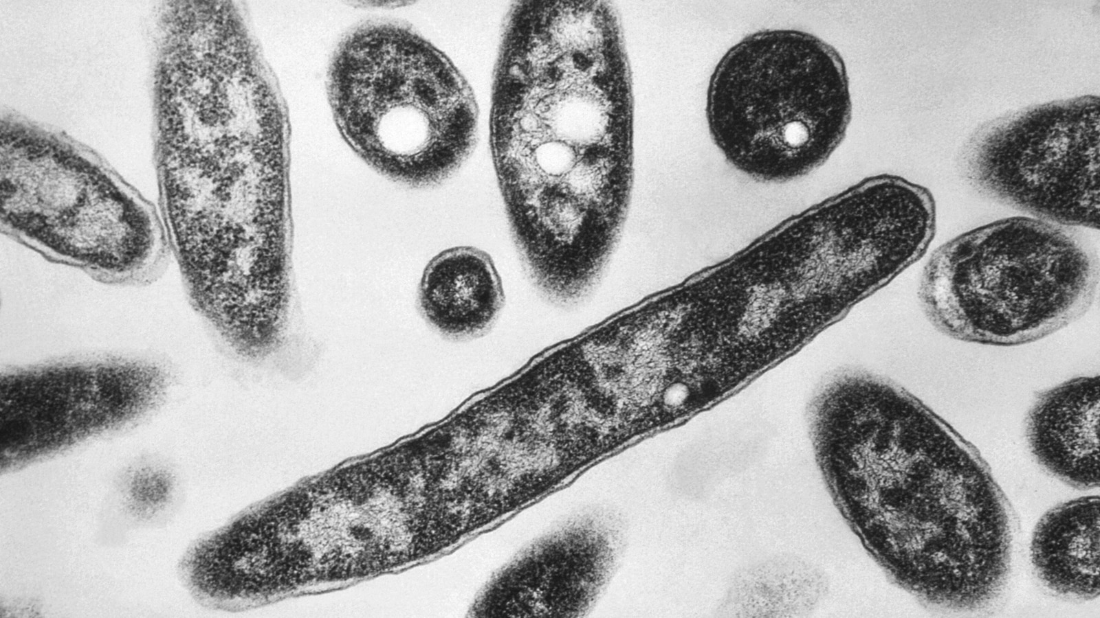 Death toll from Legionnaires' disease outbreak in New York City rises to 7