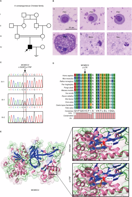 A novel MCMDC2 variant causes meiotic arrest and non-obstructive azoospermia in a consanguineous Chinese family