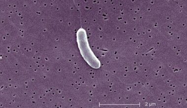 So far it has caused 26 infections in Louisiana this year - more than double the number reported in 2024