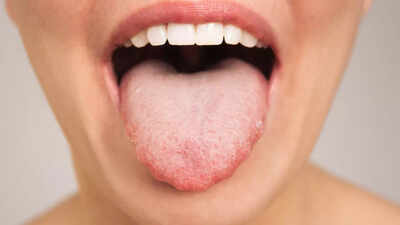 What your tongue says about your heart health