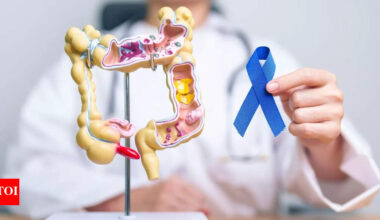 Colon cancer doctor shares five life-saving lessons: Symptoms and risks you should know |
