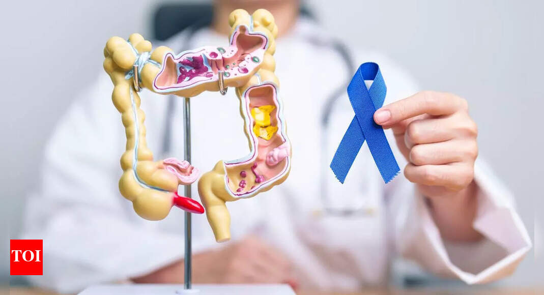 Colon cancer doctor shares five life-saving lessons: Symptoms and risks you should know |