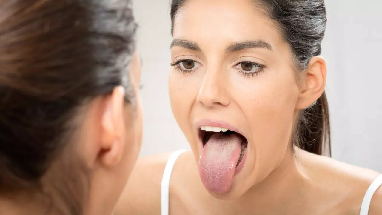 tongue