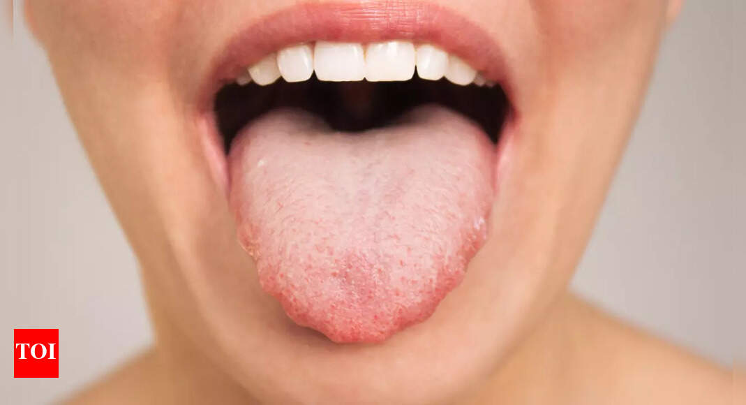 Heart Health: What your tongue says about your heart health |