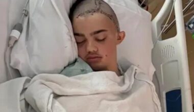 Middle Schooler Attacked by Student Over Joke, Has Parts of Skull Removed and 60 Staples Hold His Head Together