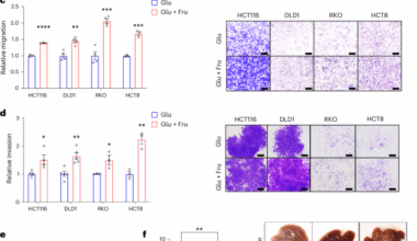 Fructose and glucose from sugary drinks enhance colorectal cancer metastasis via SORD