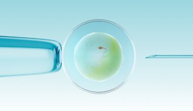 United States In-Vitro Diagnostics Market: Size, Share, and Forecast 2025–2033