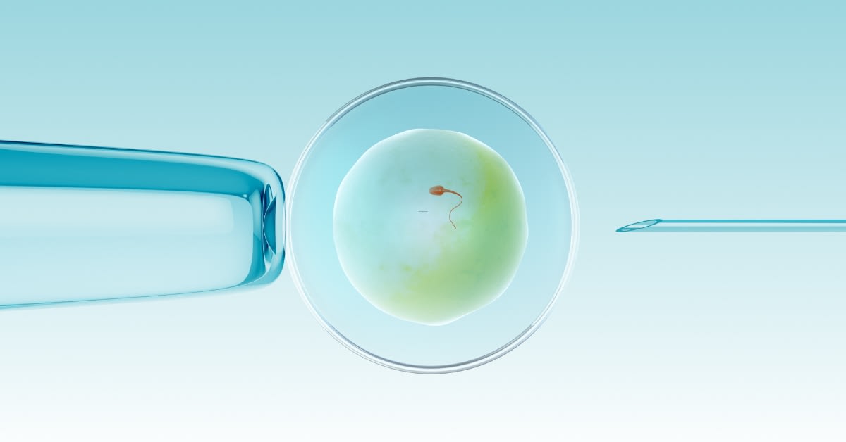 United States In-Vitro Diagnostics Market: Size, Share, and Forecast 2025–2033