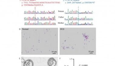 Lack of CFAP54 causes primary ciliary dyskinesia in a mouse model and human patients