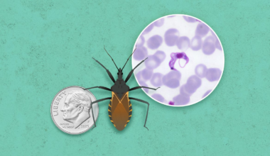 Bloodsucking 'kissing bugs' are here to stay. Maps show where.