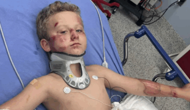 8-year-old boy on bicycle recovering after hit-and-run in Fort Worth: "He was covered in blood," mom says.